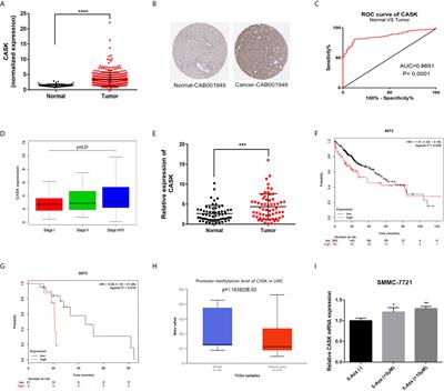 CASK Silence Overcomes Sorafenib Resistance of Hepatocellular Carcinoma Through Activating Apoptosis and Autophagic Cell Death